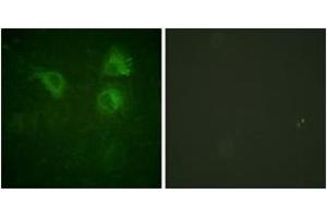 Immunofluorescence analysis of HuvEc cells, using CDC25B (Ab-323) Antibody. (CDC25B 抗体  (AA 289-338))