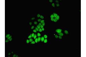 Immunofluorescent analysis of PC-3 cells using ABIN7168530 at dilution of 1:100 and Alexa Fluor 488-congugated AffiniPure Goat Anti-Rabbit IgG(H+L) (MAT2A 抗体  (AA 1-395))