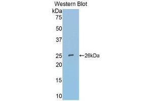 Western Blotting (WB) image for anti-Secreted Frizzled-Related Protein 4 (SFRP4) (AA 25-222) antibody (ABIN3203489) (SFRP4 抗体  (AA 25-222))