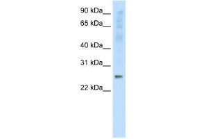 Western Blot showing SNAP25 antibody used at a concentration of 1-2 ug/ml to detect its target protein. (SNAP25 抗体  (C-Term))