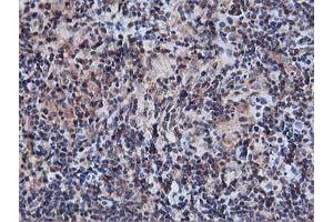 Image no. 8 for anti-V-Akt Murine Thymoma Viral Oncogene Homolog 1 (AKT1) antibody (ABIN1496557) (AKT1 抗体)