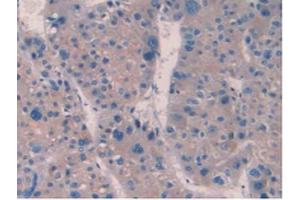 IHC-P analysis of Human Liver Tissue, with DAB staining. (IL10RB 抗体  (AA 87-243))