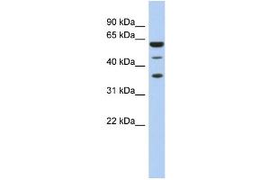 WB Suggested Anti-RDBP Antibody Titration:  0. (RDBP 抗体  (N-Term))