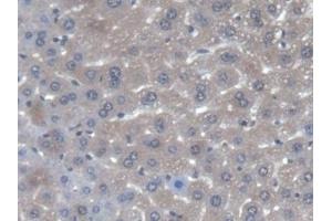 Detection of AGXT in Mouse Liver Tissue using Polyclonal Antibody to Alanine Glyoxylate Aminotransferase (AGXT) (AGXT 抗体  (AA 120-334))