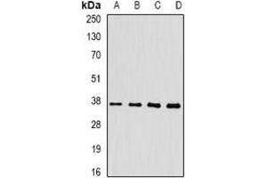 Western blot analysis of FKBP6 expression in HepG2 (A), mouse heart (B), mouse liver (C), rat testis (D) whole cell lysates. (FKBP6 抗体)