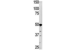Western blot analysis of PGK2 in HepG2 lysate. (PGK2 抗体  (AA 117-145))