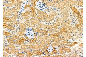 ABIN6265115 and ABIN6276896 at 1/100 staining Mouse kidney tissue by IHC-P. (SLC22A6 抗体  (C-Term))