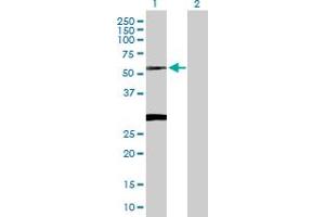Western Blot analysis of CLN3 expression in transfected 293T cell line by CLN3 MaxPab polyclonal antibody. (CLN3 抗体  (AA 1-438))