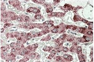 Immunohistochemistry (Paraffin-embedded Sections) (IHC (p)) image for anti-Sterol Carrier Protein 2 (SCP2) (Internal Region) antibody (ABIN1108955) (SCP2 抗体  (Internal Region))