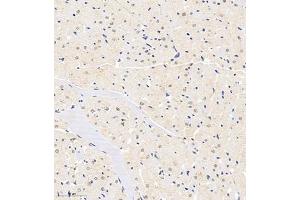 Immunohistochemistry of paraffin embedded rat heart using HDAC (ABIN7074234) at dilution of 1:1200 (300x lens) (HDAC11 抗体)