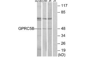 Western blot analysis of extracts from HUVEC cells, 293cells and Jurkat cells, using GPRC5B antibody. (GPRC5B 抗体  (Internal Region))