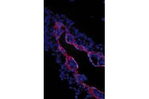 Image no. 1 for anti-Transforming Growth Factor, beta Receptor III (TGFBR3) (Extracellular Domain) antibody (ABIN265019) (TGFBR3 抗体  (Extracellular Domain))