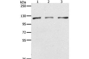Western Blot analysis of Hela, K562 and Jurkat cell using PARP1 Polyclonal Antibody at dilution of 1:350 (PARP1 抗体)