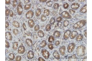 Immunoperoxidase of monoclonal antibody to IDH2 on formalin-fixed paraffin-embedded human colon. (IDH2 抗体  (AA 354-451))