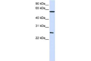 WB Suggested Anti-CCT7 Antibody Titration: 0. (CCT7 抗体  (Middle Region))