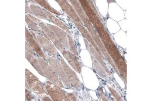 Immunohistochemical staining (Formalin-fixed paraffin-embedded sections) of human skeletal muscle with PGM1 monoclonal antibody, clone CL3299  shows moderate cytoplasmic immunoreactivity in muscle fibers. (Phosphoglucomutase 1 抗体)