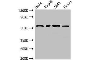 Western Blot Positive WB detected in: Hela whole cell lysate, HepG2 whole cell lysate, A549 whole cell lysate, Mouse heart tissue All lanes: MEF2D antibody at 2. (MEF2D 抗体  (AA 299-509))