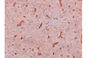 Immunohistochemistry of TWA1 in rat brain tissue with this product at 2. (GID8/C20orf11 抗体  (C-Term))