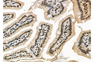 ABIN6259584 and ABIN6273572 at 1/100 staining Mouse colorectal tissue by IHC-P.