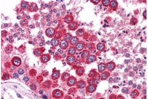 Human Testis: Formalin-Fixed, Paraffin-Embedded (FFPE)