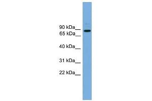 ARHGEF19 antibody used at 1 ug/ml to detect target protein. (ARHGEF19 抗体)