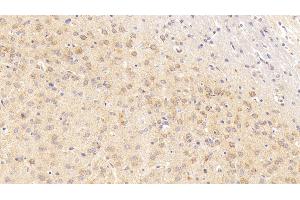 Detection of COX2 in Rat Cerebrum Tissue using Polyclonal Antibody to Cytochrome C Oxidase Subunit II (COX2) (COX2 抗体  (AA 83-227))