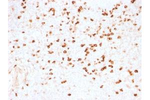 Formalin-fixed, paraffin-embedded human Tonsil stained with Lambda Light Chain Monoclonal Antibody (N10/2). (IgL 抗体)