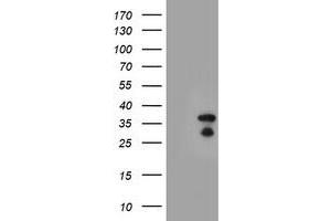 Western Blotting (WB) image for anti-Hes Family bHLH Transcription Factor 1 (HES1) antibody (ABIN1498633) (HES1 抗体)