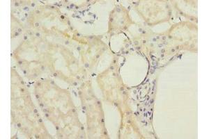 Immunohistochemistry of paraffin-embedded human kidney tissue using ABIN7142381 at dilution of 1:100 (MRPL22 抗体  (AA 41-206))