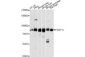 Western blot analysis of extracts of various cell lines, using PARP12 antibody. (PARP12 抗体)