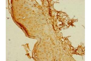 Immunohistochemistry of paraffin-embedded human skin tissue using ABIN7174896 at dilution of 1:100 (C8orf34 抗体  (AA 1-300))