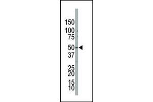 Image no. 1 for anti-Phosphatidylinositol-5-Phosphate 4-Kinase, Type II, beta (PIP4K2B) (C-Term) antibody (ABIN360485)