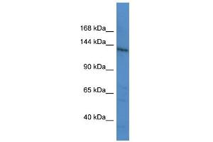 WB Suggested Anti-LTBP1 Antibody Titration: 0. (LTBP1 抗体  (C-Term))