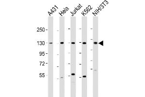 All lanes : Anti-DDX42 Antibody (N-Term) at 1:2000 dilution Lane 1: A431 whole cell lysate Lane 2: Hela whole cell lysate Lane 3: Jurkat whole cell lysate Lane 4: K562 whole cell lysate Lane 5: NIH/3T3 whole cell lysate Lysates/proteins at 20 μg per lane. (DDX42 抗体  (AA 104-138))