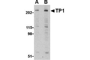 Western Blotting (WB) image for anti-Transition Protein 1 (During Histone To Protamine Replacement) (TNP1) (N-Term) antibody (ABIN1031638) (TNP1 抗体  (N-Term))