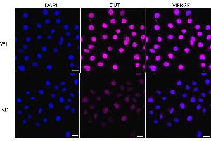 Immunocytochemical staining of HeLa cells using DUT antibody (ABIN7798312), 1:1,000), Top panel: wild-type (WT), Bottom panal: DUT shRNA knockdown (KD). (Recombinant Deoxyuridine Triphosphatase (DUT) 抗体)