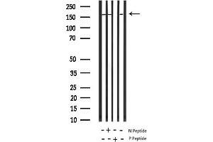 anti-Insulin Receptor Substrate 1 (IRS1) (pSer639) antibody