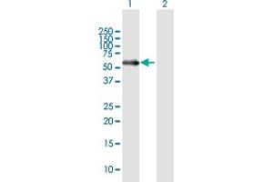 Western Blot analysis of MATN1 expression in transfected 293T cell line by MATN1 MaxPab polyclonal antibody. (MATN1 抗体  (AA 1-496))
