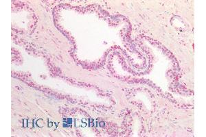ABIN5539626 (5µg/ml) staining of paraffin embedded Human Prostate. (DPF2 抗体  (AA 245-259))