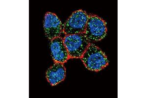 Confocal immunofluorescent analysis of ESR1/ER Antibody (Center) (ABIN657470 and ABIN2846498) with ZR-75-1 cell followed by Alexa Fluor 488-conjugated goat anti-rabbit lgG (green). (Estrogen Receptor alpha 抗体  (AA 246-273))