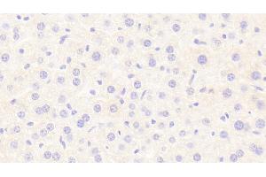 Detection of LIPC in Mouse Liver Tissue using Polyclonal Antibody to Lipase, Hepatic (LIPC) (LIPC 抗体  (AA 159-415))