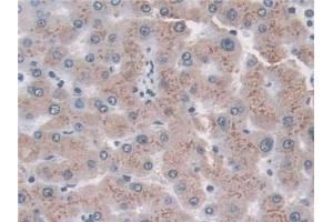 Immunohistochemistry (IHC) image for anti-Tripeptidyl Peptidase I (TPP1) (AA 1-320) antibody (ABIN7435157)