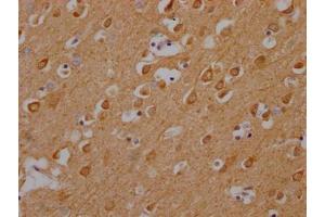 IHC image of ABIN7146440 diluted at 1:200 and staining in paraffin-embedded human brain tissue performed on a Leica BondTM system. (CAMK2A 抗体  (AA 321-478))