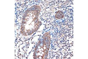 Immunohistochemistry of paraffin-embedded human appendix using LI Cadherin/Cadherin-17 Rabbit mAb (ABIN7268249) at dilution of 1:100 (40x lens). (LI Cadherin 抗体)