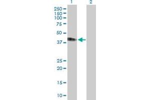 Western Blot analysis of IFNAR2 expression in transfected 293T cell line by IFNAR2 MaxPab polyclonal antibody. (IFNAR2 抗体  (AA 1-331))