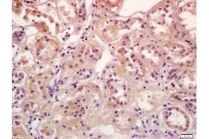 Formalin-fixed and paraffin embedded human kidney labeled with Anti-Phospho-SGK1 (Ser78) Polyclonal Antibody, Unconjugated (ABIN745688) at 1:200 followed by conjugation to the secondary antibody and DAB staining (SGK1 抗体  (pSer78))