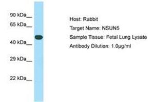 Image no. 1 for anti-NOP2/Sun Domain Family, Member 5 (NSUN5) (C-Term) antibody (ABIN6749897) (NSUN5 抗体  (C-Term))