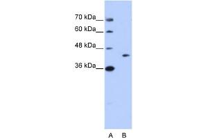 WB Suggested Anti-GIPC1 Antibody Titration:  0. (GIPC1 抗体  (N-Term))