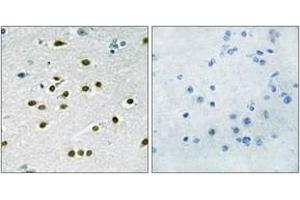 Immunohistochemistry analysis of paraffin-embedded human brain tissue, using KLF10/11 Antibody. (KLF10/11 抗体  (AA 391-440))