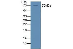 Detection of COX-1 in Human A431 Cells using Polyclonal Antibody to Cyclooxygenase 1 (COX-1) (PTGS1 抗体  (AA 367-599))